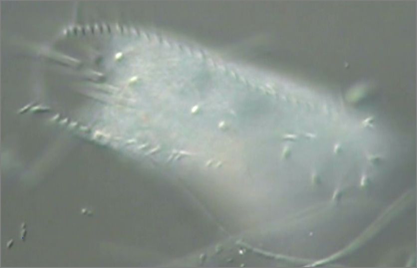 滴虫界 (Infusorian World）Ciliates，Amoebae，Flagellates，etc... : Stylonychia ...