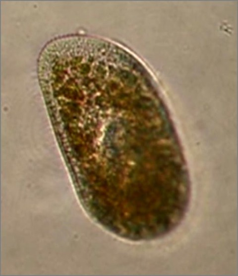 滴虫界 (Infusorian World）Ciliates，Amoebae，Flagellates，etc... : Paramecium ...