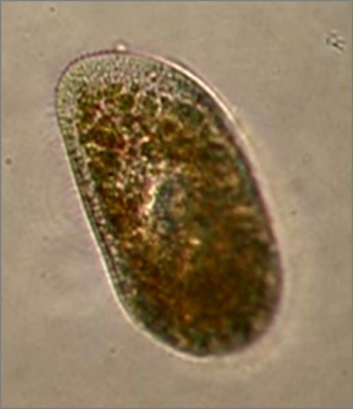 Paramecium bursaria ミドリゾウリムシ（ゾウリムシ類） : 滴虫