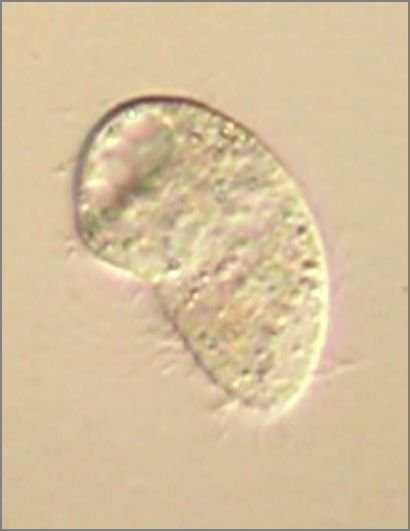 滴虫界 (Infusorian World）Ciliates，Amoebae，Flagellates，etc... : Colpoda ...