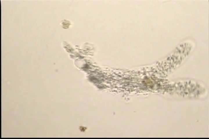 滴虫界 (Infusorian World）Ciliates，Amoebae，Flagellates，etc... : Amoeba proteus