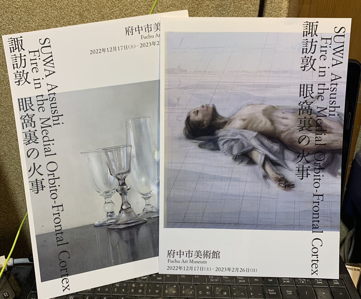 諏訪敦 眼窩裏の火事（府中市美術館） : ヒグえもんのブログ