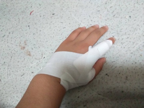 区立小学校組体操事故