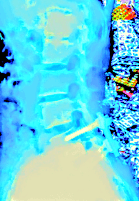 ns0nIY3uFtsTxAKAG0nt1783113012-1783113153