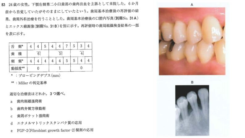 毎年問われるこの問題。 : ロムニーハウス勉強会® 119回 歯科