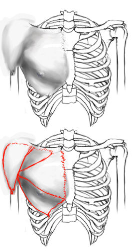 胸 大胸筋と肋骨について イラストのはなしをしよう