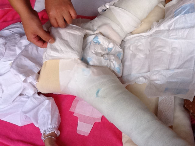 術後 優里と慶次とママ