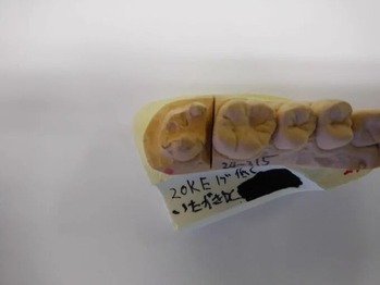 20K����졼��