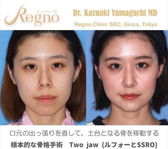 女さん「整形、親にバレてた。」←親からの手紙が泣けると話題に