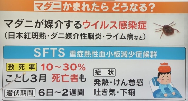168354185742dvz-medium