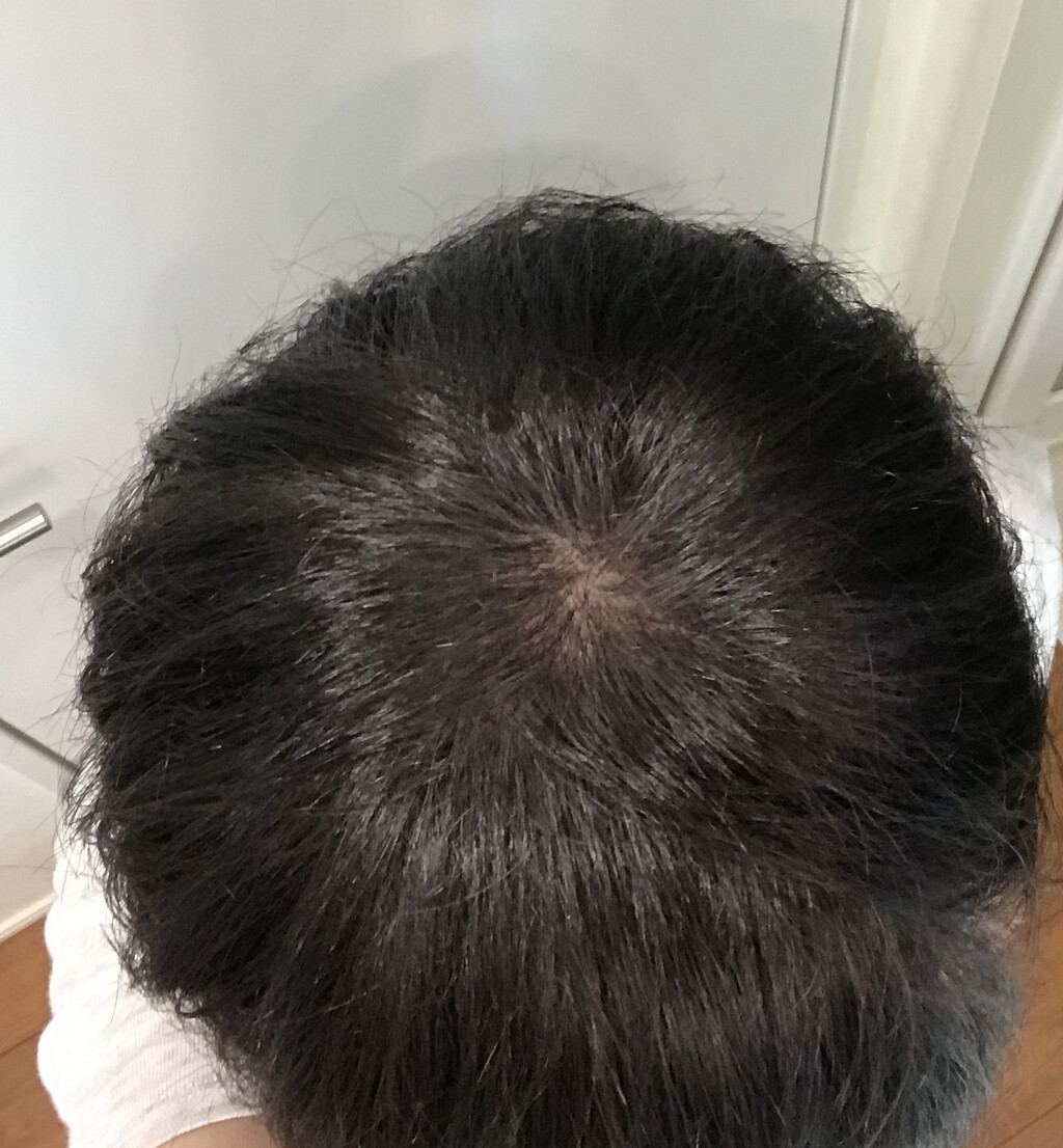 カラートリートメントでグレーヘア移行を乗り切ろう 空カフェ ゆる猫との暮らし Powered By ライブドアブログ カラートリートメントでグレーヘア移行を乗り切ろう 空カフェ ゆる猫との暮らし Powered By ライブドアブログ