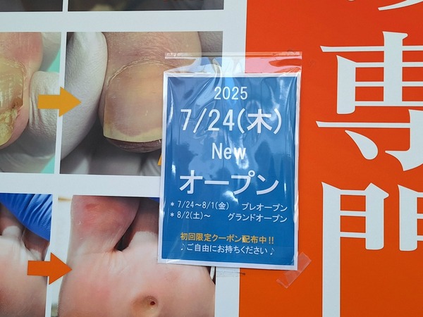 巻き爪補正店6