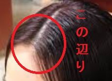 教えて 出産後の抜け毛はどのくらいで直るものなんですか 産後の抜け毛が気になるときに見るブログ