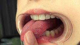 TV091_8383_520