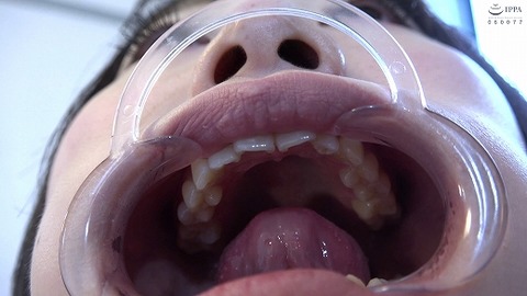 TV051_0977_520