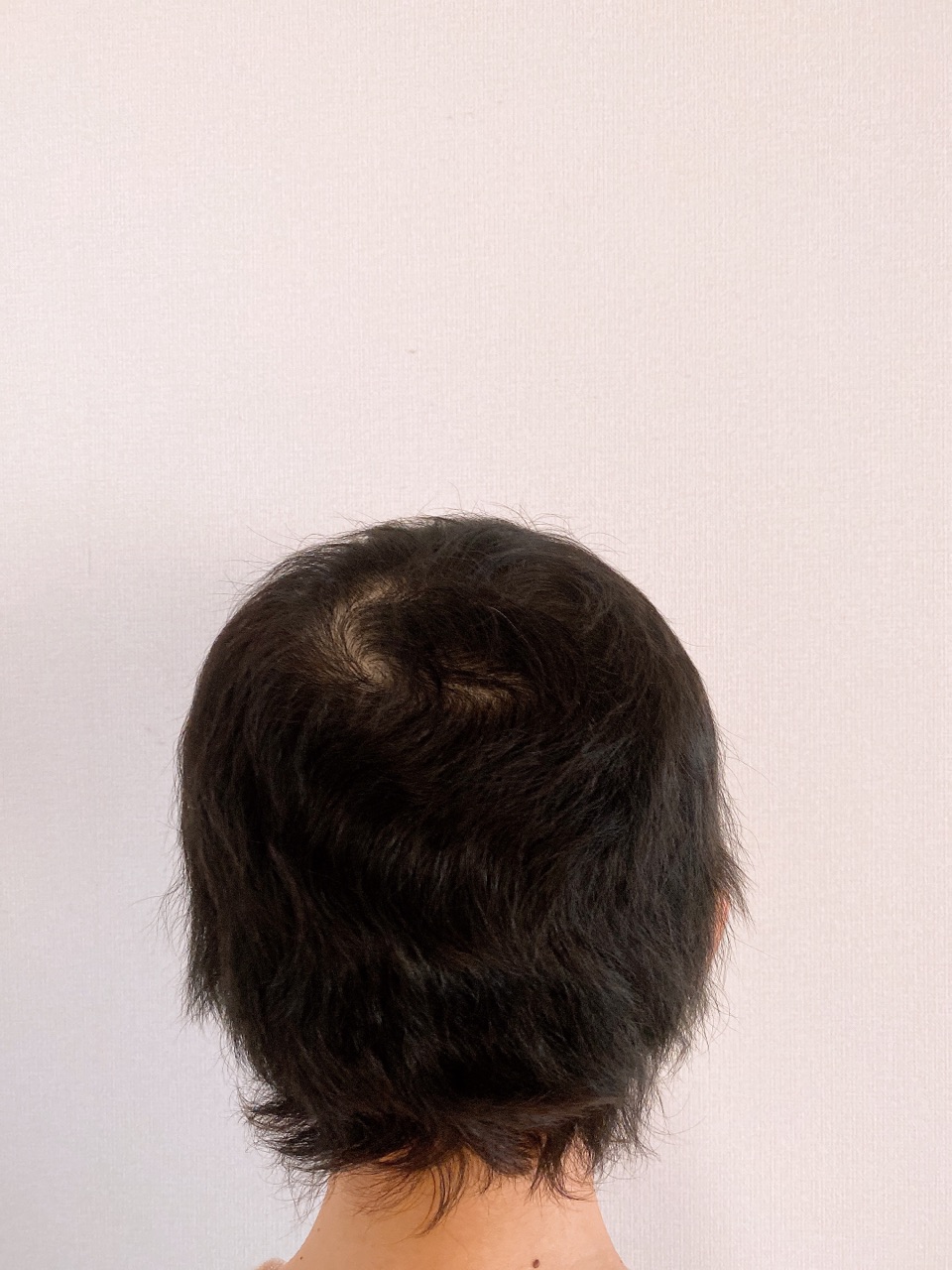 ラストケモ5か月 果たして脱ウィッグなるか Jamのおうち ごはんと器とインテリア Powered By ライブドアブログ