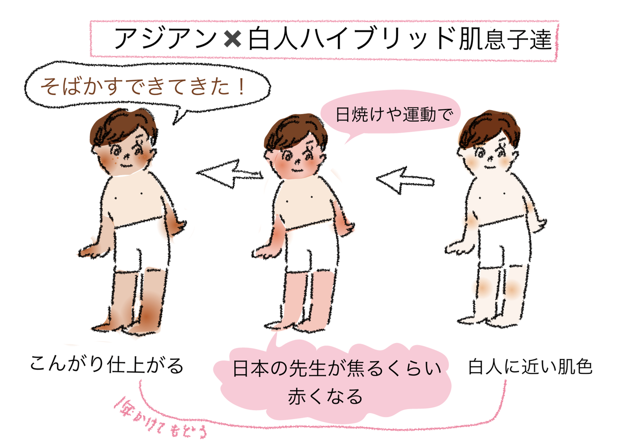 日焼けの仕方 白人 白人アジアンハーフの違い我が家の場合 ハイブリッドキッズ育児日誌 コレってあるあるですか