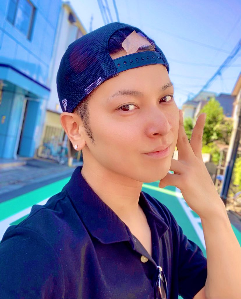 イケメン俳優 間瀬翔太 難病で顔面が ひきこもりオジサン的気になるニュース