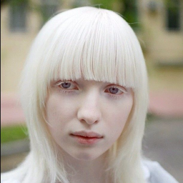 まるで「エルフの女王」 突然変異によって生まれた美しすぎるアルビノの女の子 : オレ的ゲーム速報@刃