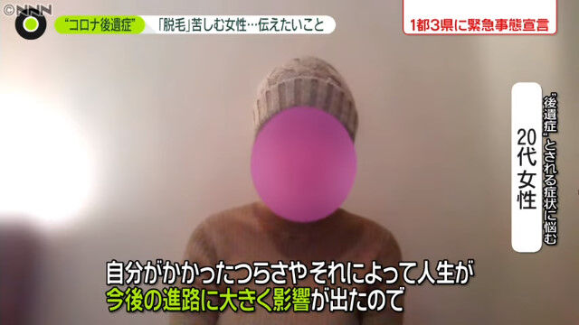 新型コロナ 女子大学院生 後遺症 脱毛 ハゲに関連した画像-11