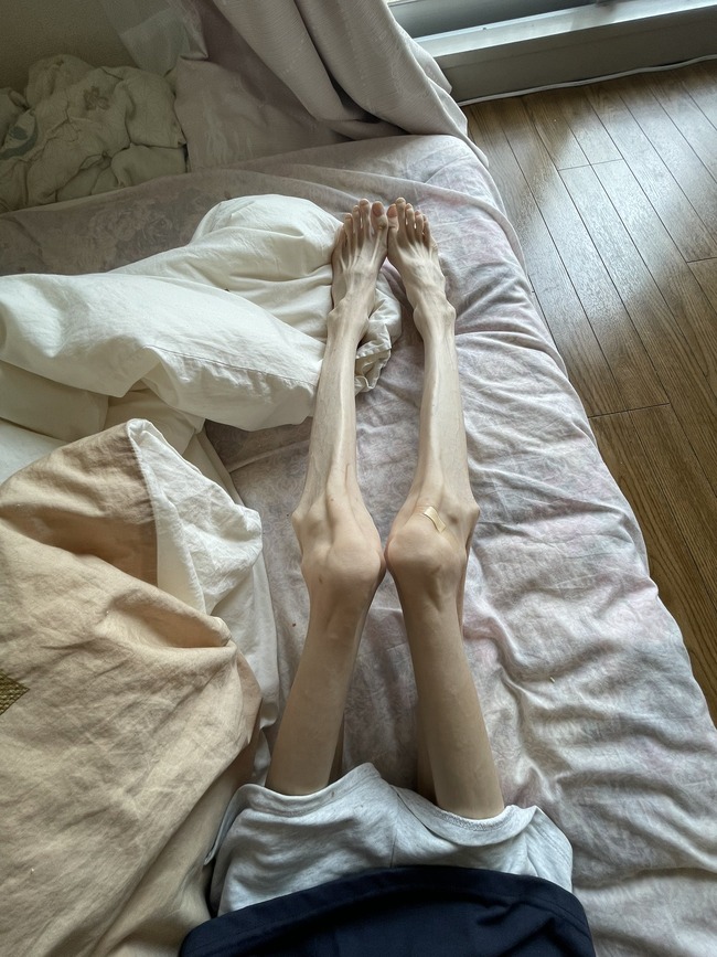 体重 BMI 身長 体型 食事 摂食障害に関連した画像-06