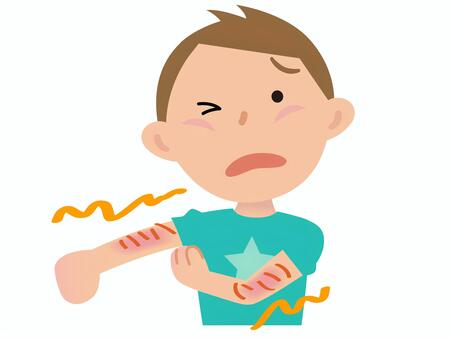 九州大学　アトピー性皮膚炎　痒み　免疫に関連した画像-01