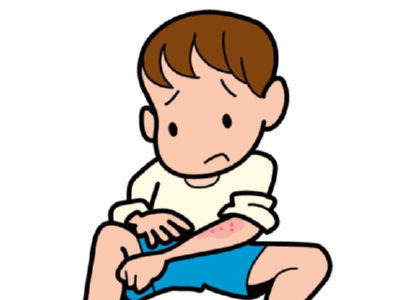 はしか 麻疹 パンデミック 関西 関東に関連した画像-01