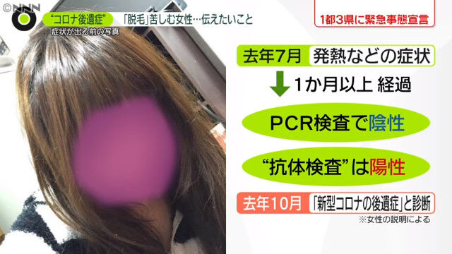 新型コロナ 女子大学院生 後遺症 脱毛 ハゲに関連した画像-04