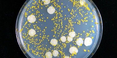 食器のつけ置きがヤバイ 10時間で排水口並みに菌が繁殖 食べたらすぐ洗おう オレ的ゲーム速報 刃