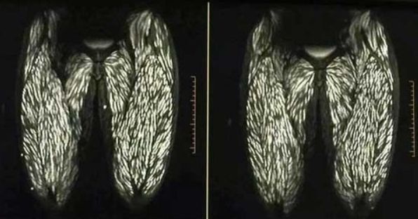 閲覧注意 豚肉を生で10年間食べ続けた女性 全身が寄生虫に侵食される オレ的ゲーム速報 刃