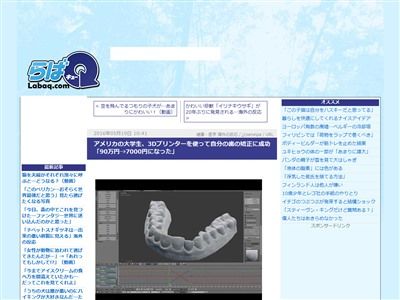 3Dプリンター 歯の矯正 自作に関連した画像-02