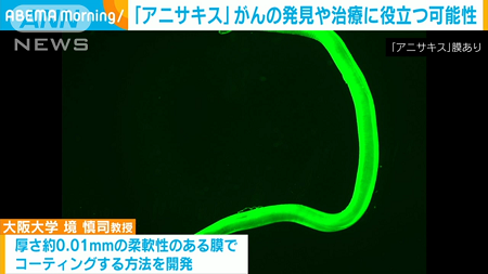 アニサキス　がん　痛み　治療　大阪大学　研究　寄生虫に関連した画像-01