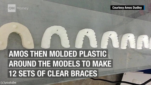 3Dプリンター 歯の矯正 自作に関連した画像-03