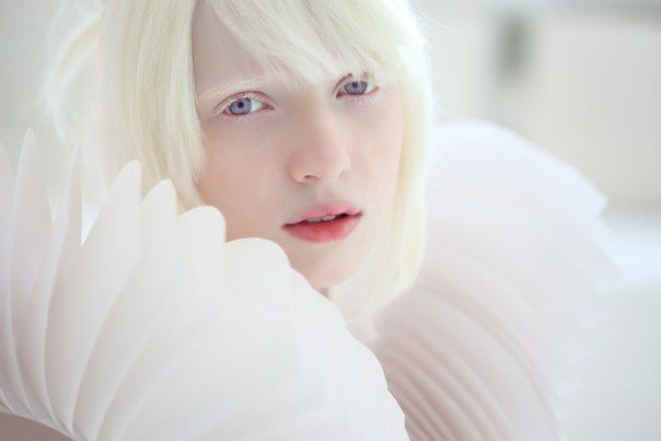 まるで「エルフの女王」 突然変異によって生まれた美しすぎるアルビノの女の子 : オレ的ゲーム速報＠刃