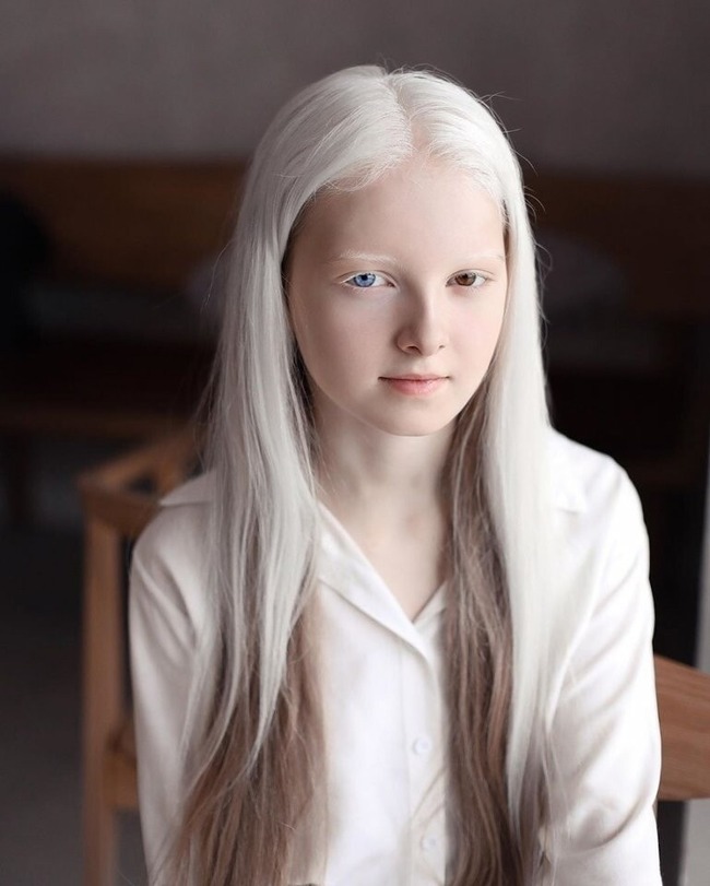 ロシアでアルビノ オッドアイの美少女が発見される マジで人形みたいなんだけど オレ的ゲーム速報 刃 ロシアでアルビノ オッドアイの美少女が発見される マジで人形みたいなんだけど オレ的ゲーム速報 刃