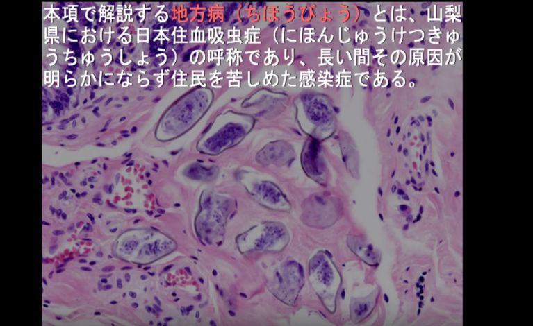 日本住血吸虫 サウンドノベルに関連した画像-01