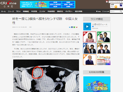 �������ˡ�����ѥ���������˥󡡳����С����С�Ĳ�ĺɤ˴�Ϣ��������-02