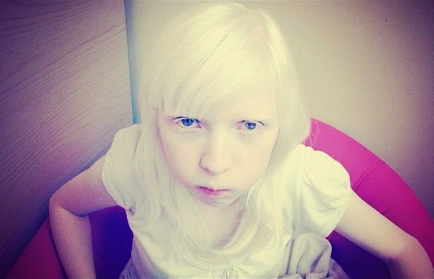 まるで「エルフの女王」 突然変異によって生まれた美しすぎるアルビノの女の子 : オレ的ゲーム速報＠刃