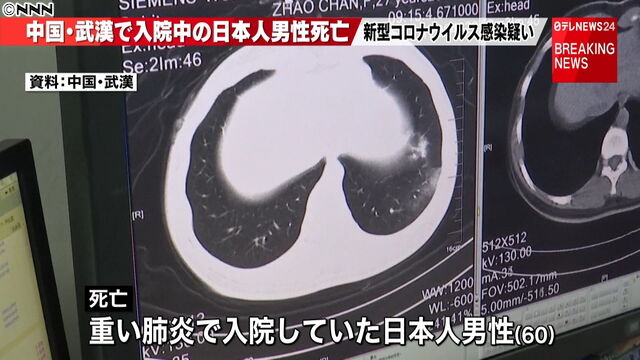 新型コロナウイルス 新型肺炎 日本人 武漢 死亡に関連した画像-01