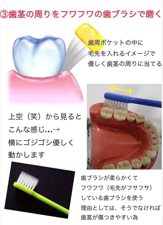 歯 歯科衛生士 オタク ハミガキに関連した画像-04