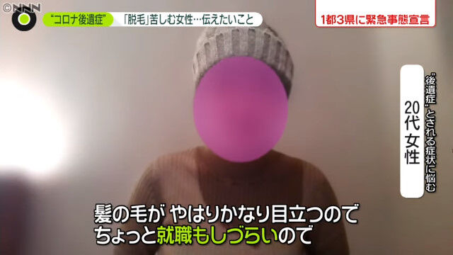 新型コロナ 女子大学院生 後遺症 脱毛 ハゲに関連した画像-09