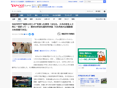 画像あり 身長167cmだった男性 500万円で10cm伸ばす手術をして人生が変わる その驚きの手法がこちら オレ的ゲーム速報 刃 画像あり 身長167cmだった男性 500万円で10cm伸ばす手術をして人生が変わる その驚きの手法がこちら オレ的ゲーム速報 刃