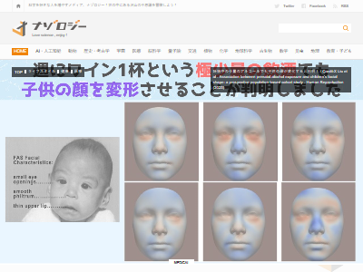 妊娠中のアルコール摂取は、子供の顔面を変形させてしまうことが判明!その赤ちゃんの顔の特徴がこちら… : オレ的ゲーム速報@刃