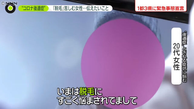 新型コロナ 女子大学院生 後遺症 脱毛 ハゲに関連した画像-05