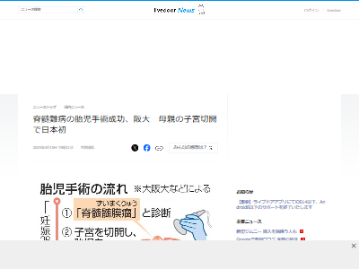 胎児 手術 大阪大学 脊髄髄膜瘤 難病に関連した画像-02