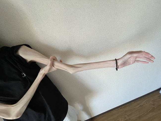 体重 BMI 身長 体型 食事 摂食障害に関連した画像-07