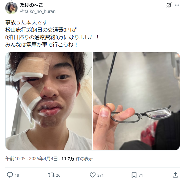 自転車　事故　チェーン　歩道　車道に関連した画像-03
