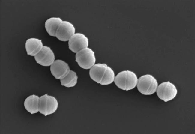 劇症型溶血性レンサ球菌感染症　人食いバクテリア　日本　患者　感染に関連した画像-01
