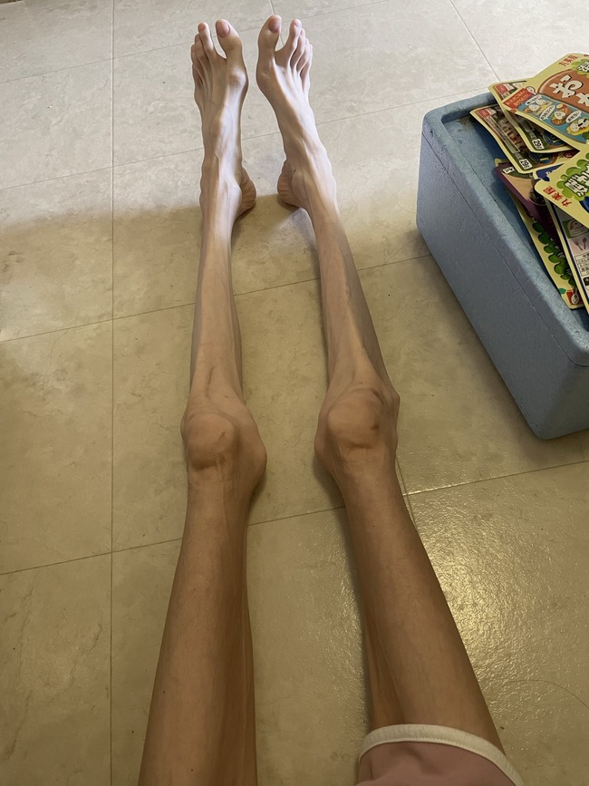 体重 BMI 身長 体型 食事 摂食障害に関連した画像-08