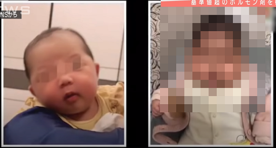 中国製クリーム赤ちゃん顔肥大に関連した画像-01